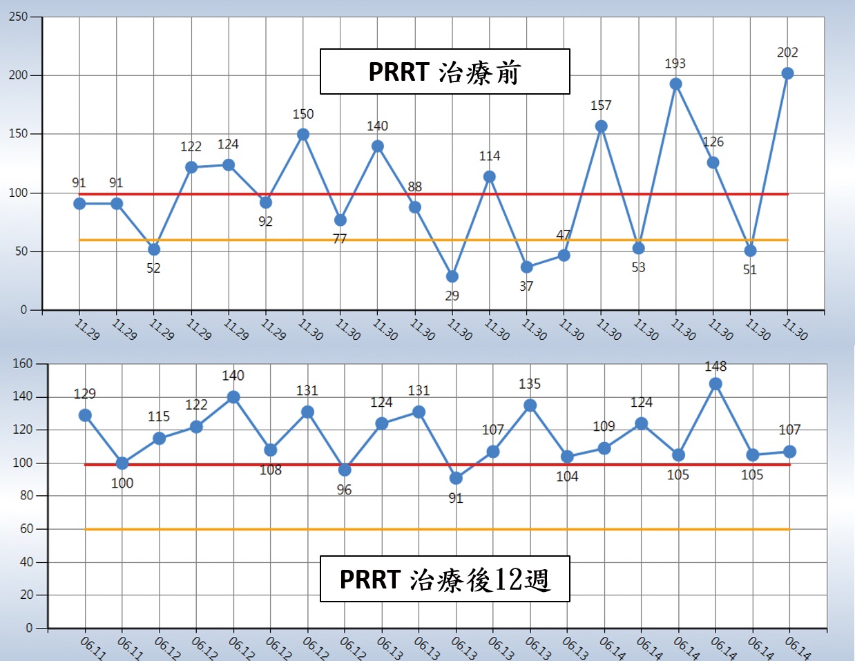 圖三病人治療前後血糖變化圖上可見每日有多次反覆發生嚴重低血糖之情形仍需以高濃度糖水急救圖下為治療後12週之血糖變化已無再發生低血糖之情況